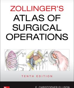 Zollinger’s Atlas of Surgical Operations 10th Edition – PDF ebook