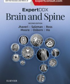 ExpertDDx: Brain and Spine 2nd Edition – PDF ebook