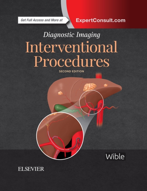 Diagnostic Imaging: Interventional Procedures 2nd Edition – PDF ebook Diagnostic Imaging: Interventional Procedures 2nd Edition – PDF ebook