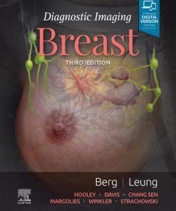 Diagnostic Imaging: Breast 3rd Edition – PDF ebook
