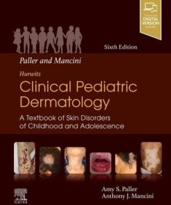 Paller and Mancini – Hurwitz Clinical Pediatric Dermatology, A Textbook of Skin Disorders of Childhood and Adolescence 6th Edition – PDF ebook