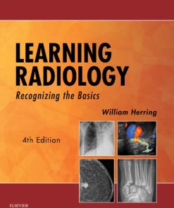 Learning Radiology, Recognizing the Basics 4th Edition – PDF ebook