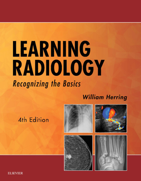 Learning Radiology, Recognizing the Basics 4th Edition – PDF ebook Learning Radiology, Recognizing the Basics 4th Edition – PDF ebook