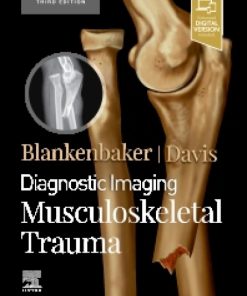 Diagnostic Imaging: Musculoskeletal Trauma 3rd Edition – PDF ebook