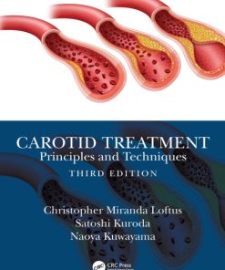 Carotid Treatment: Principles and Techniques 3rd Edition – PDF ebook