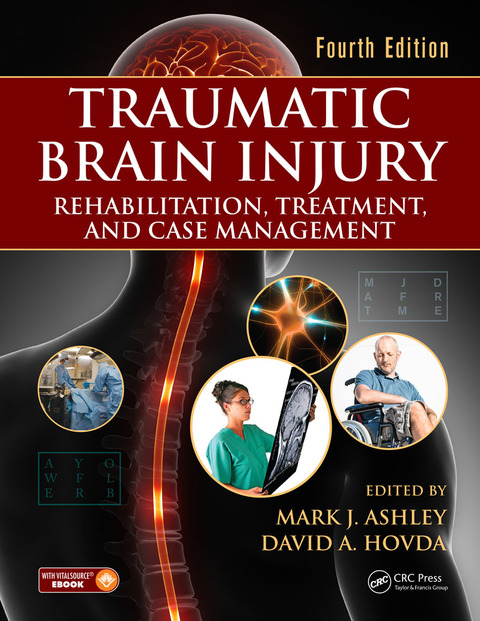 Traumatic Brain Injury, Rehabilitation, Treatment, and Case Management, 4th Edition – PDF ebook Traumatic Brain Injury, Rehabilitation, Treatment, and Case Management, 4th Edition – PDF ebook