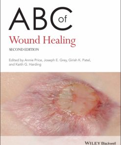 ABC of Wound Healing 2nd Edition – PDF ebook