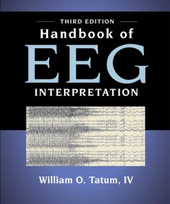 Handbook of EEG Interpretation 3rd Edition – PDF ebook