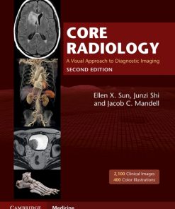 Core Radiology,A Visual Approach to Diagnostic Imaging 2nd Edition – PDF ebook