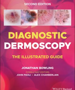 Diagnostic Dermoscopy, The Illustrated Guide 2nd Edition – PDF ebook