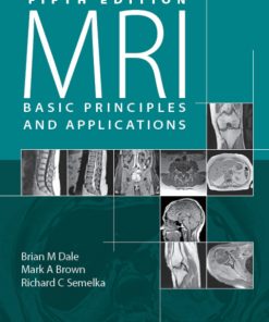 MRI: Basic Principles and Applications, Basic Principles and Applications 5th Edition – PDF ebook
