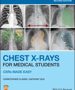 Chest X-Rays for Medical Students 2nd Edition – PDF ebook