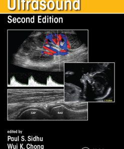Measurement in Ultrasound 2nd Edition – PDF ebook