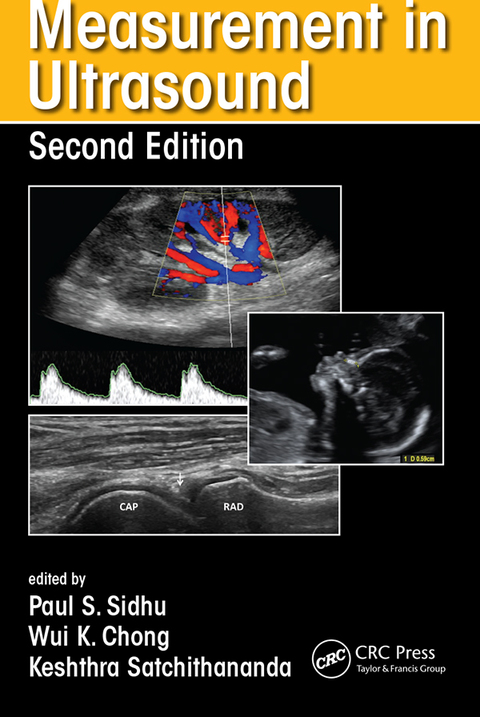 Measurement in Ultrasound 2nd Edition – PDF ebook Measurement in Ultrasound 2nd Edition – PDF ebook