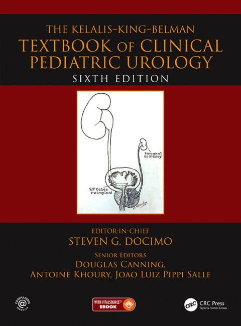 The Kelalis–King–Belman Textbook of Clinical Pediatric Urology 6th Edition – PDF ebook The Kelalis–King–Belman Textbook of Clinical Pediatric Urology 6th Edition – PDF ebook