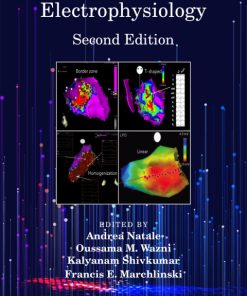 Handbook of Cardiac Electrophysiology 2nd Edition – PDF ebook