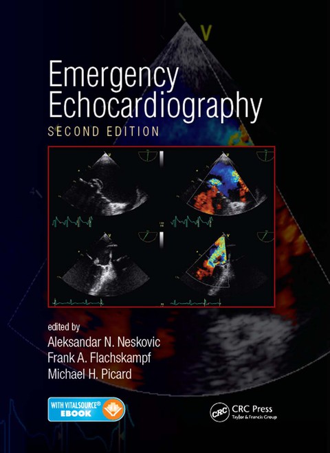 Emergency Echocardiography 2nd Edition – PDF ebook Emergency Echocardiography 2nd Edition – PDF ebook