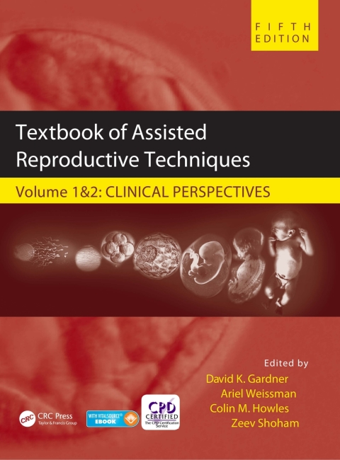 Textbook of Assisted Reproductive Techniques, Two Volume Set 5th Edition – PDF ebook Textbook of Assisted Reproductive Techniques, Two Volume Set 5th Edition – PDF ebook