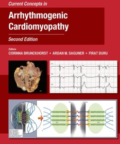 Current Concepts in Arrhythmogenic Cardiomyopathy, Second Edition 2nd Edition – PDF ebook