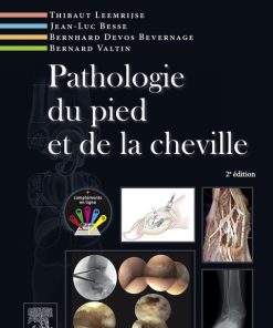 Pathologie du pied et de la cheville 2nd Edition – PDF ebook
