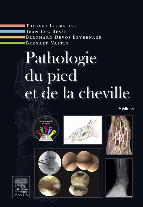 Pathologie du pied et de la cheville 2nd Edition – PDF ebook Pathologie du pied et de la cheville 2nd Edition – PDF ebook