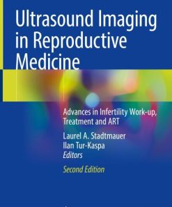Ultrasound Imaging in Reproductive Medicine, Advances in Infertility Work-up, Treatment and ART 2nd Edition – PDF ebook
