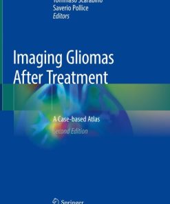 Imaging Gliomas After Treatment, A Case-based Atlas 2nd Edition – PDF ebook