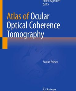 Atlas of Ocular Optical Coherence Tomography 2nd Edition – PDF ebook