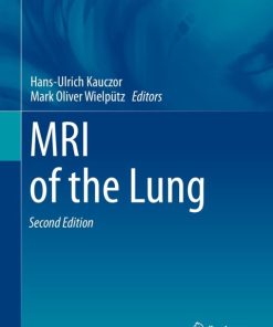 MRI of the Lung 2nd Edition – PDF ebook