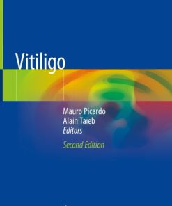 Vitiligo 2nd Edition – PDF ebook