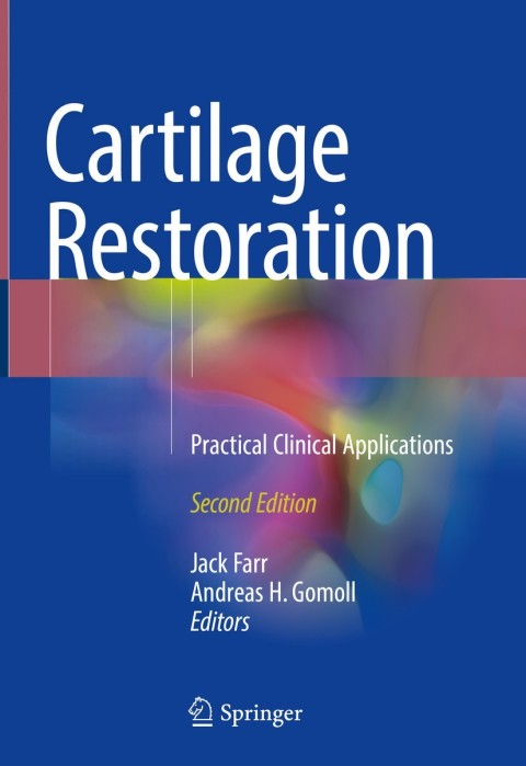Cartilage Restoration, Practical Clinical Applications 2nd Edition – PDF ebook Cartilage Restoration, Practical Clinical Applications 2nd Edition – PDF ebook