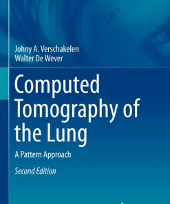 Computed Tomography of the Lung, A Pattern Approach 2nd Edition – PDF ebook