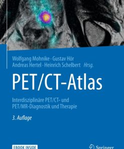 PET/CT-Atlas, Interdisziplinäre PET/CT- und PET/MR-Diagnostik und Therapie 3rd Edition – PDF ebook