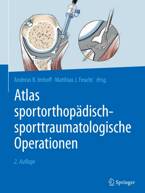 Atlas sportorthopädisch-sporttraumatologische Operationen 2nd Edition – PDF ebook Atlas sportorthopädisch-sporttraumatologische Operationen 2nd Edition – PDF ebook