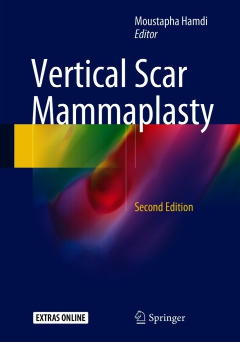 Vertical Scar Mammaplasty 2nd Edition – PDF ebook Vertical Scar Mammaplasty 2nd Edition – PDF ebook