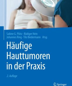 Häufige Hauttumoren in der Praxis 2nd Edition – PDF ebook