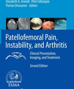 Patellofemoral Pain, Instability, and Arthritis 2nd Edition Clinical Presentation, Imaging, and Treatment – PDF ebook
