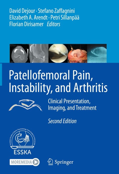 Patellofemoral Pain, Instability, and Arthritis 2nd Edition Clinical Presentation, Imaging, and Treatment – PDF ebook Patellofemoral Pain, Instability, and Arthritis 2nd Edition Clinical Presentation, Imaging, and Treatment – PDF ebook